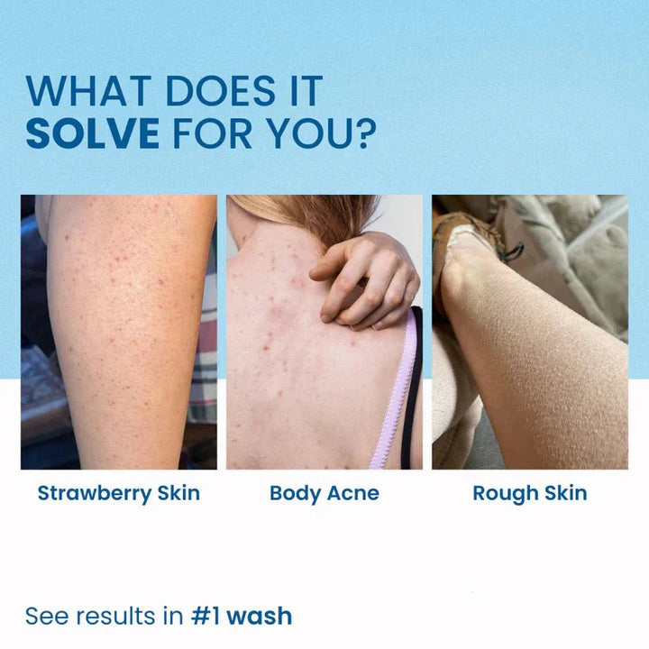 SALICYLIC ACID Body Wash - Dime Natural