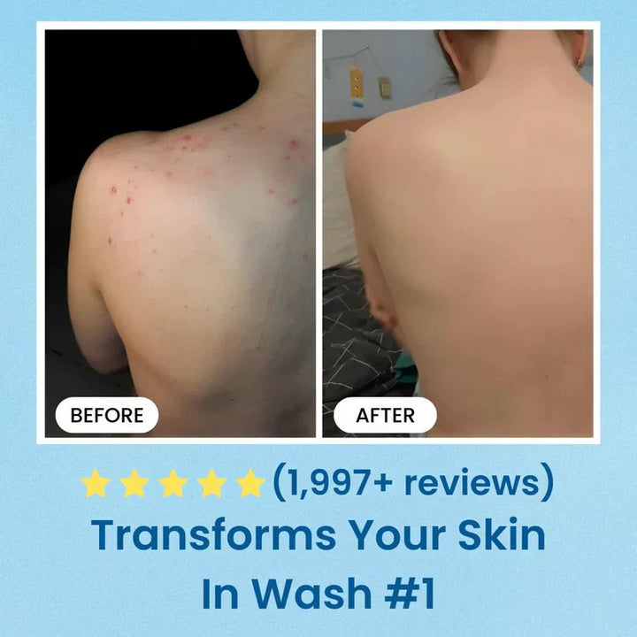 SALICYLIC ACID Body Wash - Dime Natural